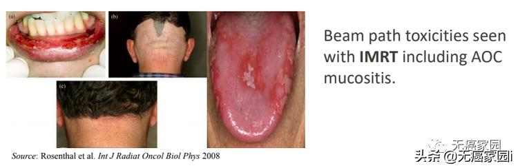 5年生存率超过90%是不是治疗率高,5年生存率图