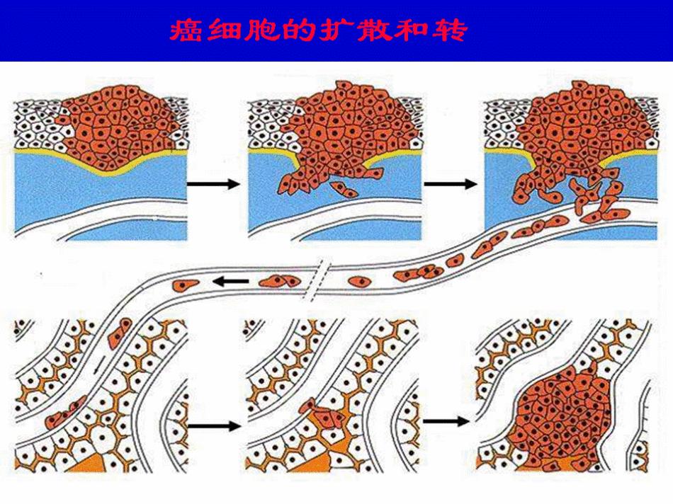 感染艾滋病毒后，你还能活多久？