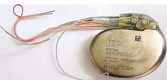 体内有金属植入患者怎么做核磁,体内有植入物可以做磁共振检查吗