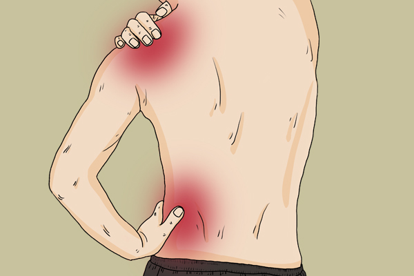 总觉得腰疼是什么原因,感觉腰疼怎么排除肾的问题