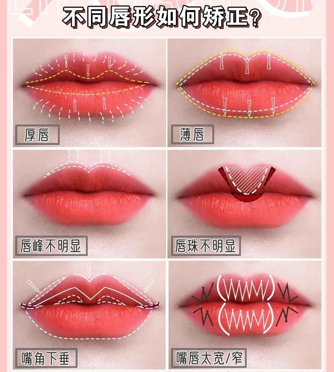 唇形整容,矫正唇形最好看的方法
