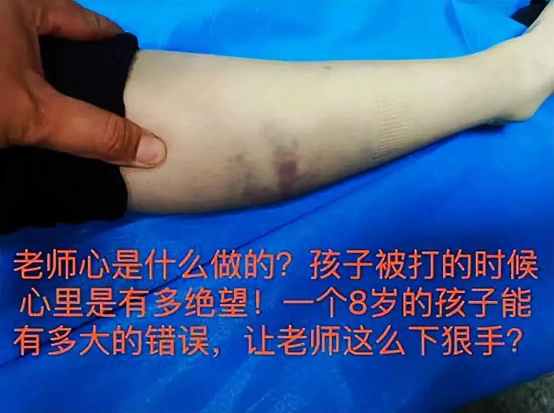 青岛武术馆事件真相,青岛聚英武术俱乐部打人怎么判刑