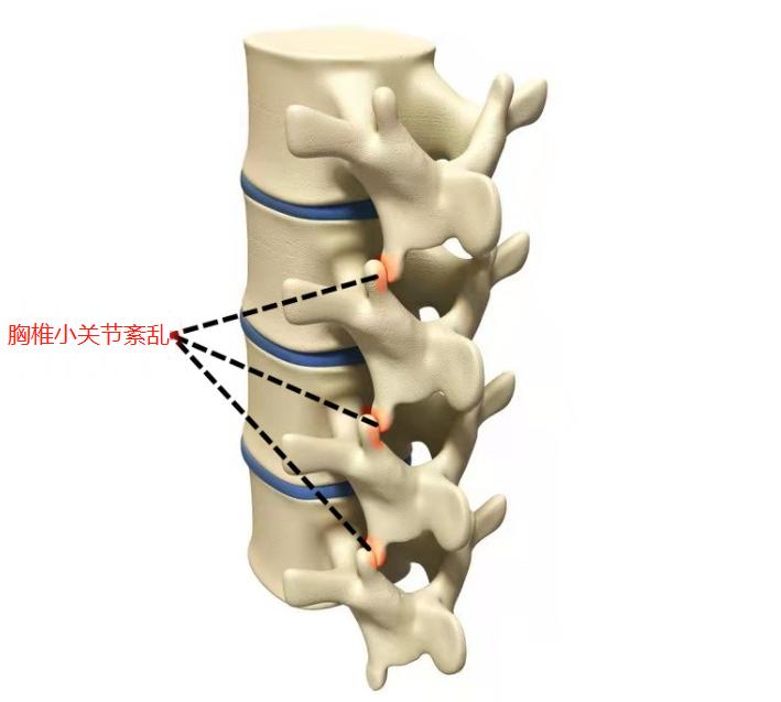心脏病后背痛和肺癌后背痛的区别,58岁后背疼痛怎么回事