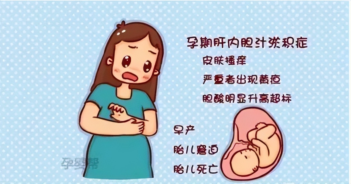 身上痒是怀孕的征兆吗,孕妇胆汁淤积发痒图片