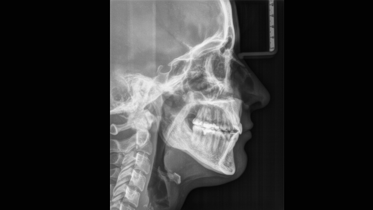 西诺德口腔全景机维修,西诺德口腔ct机