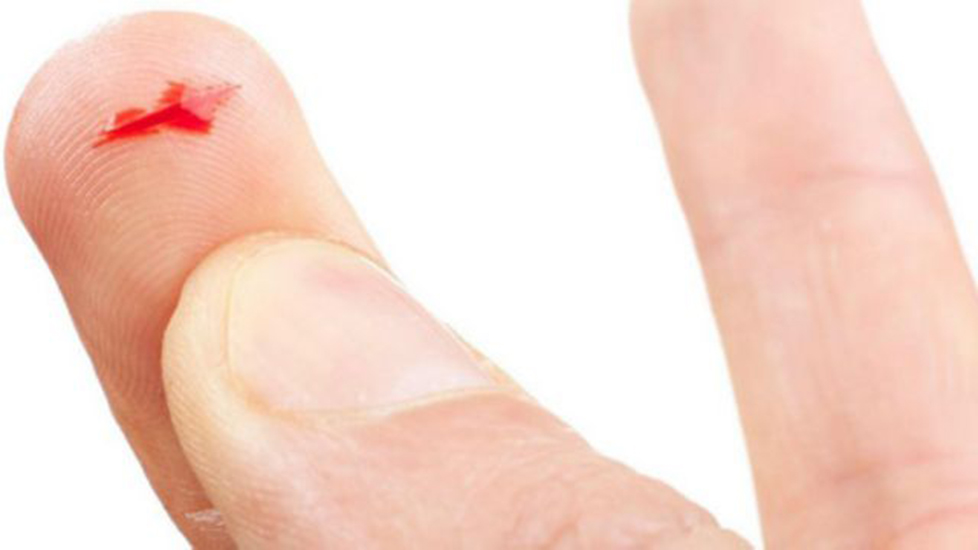 天生没有指纹的人是怎么回事,天生无指纹的人