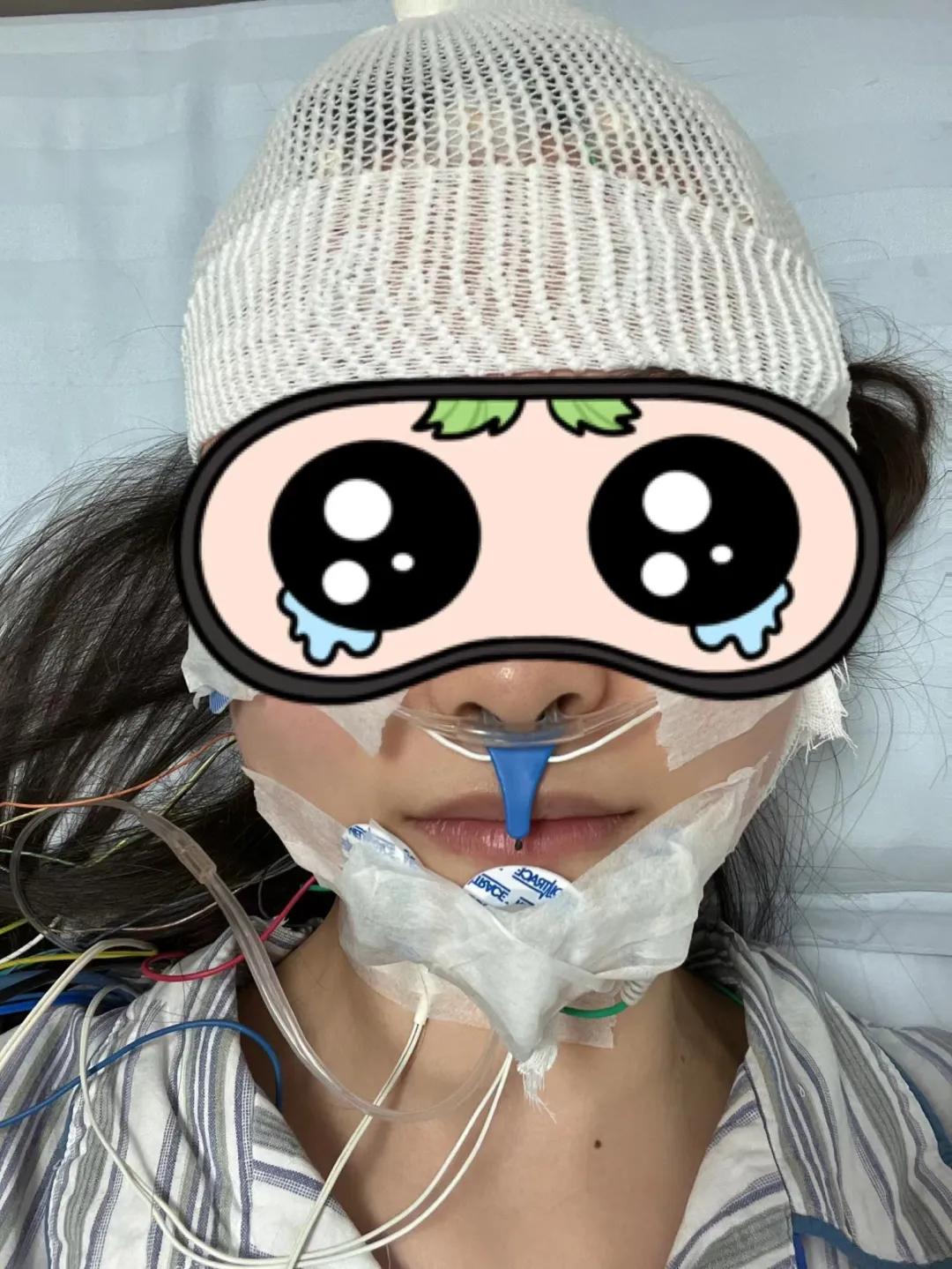 好像腿里有鱼在游还吐泡泡，医生把我捆起来做了一晚监测