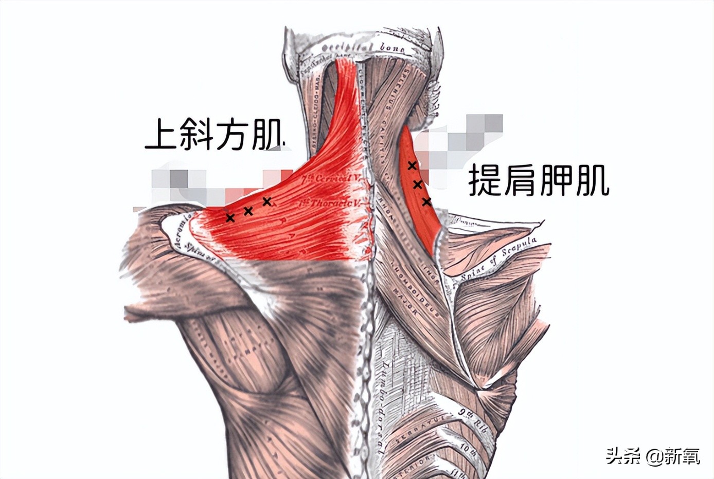 富豪千金妮可拉,富家千金妮可拉