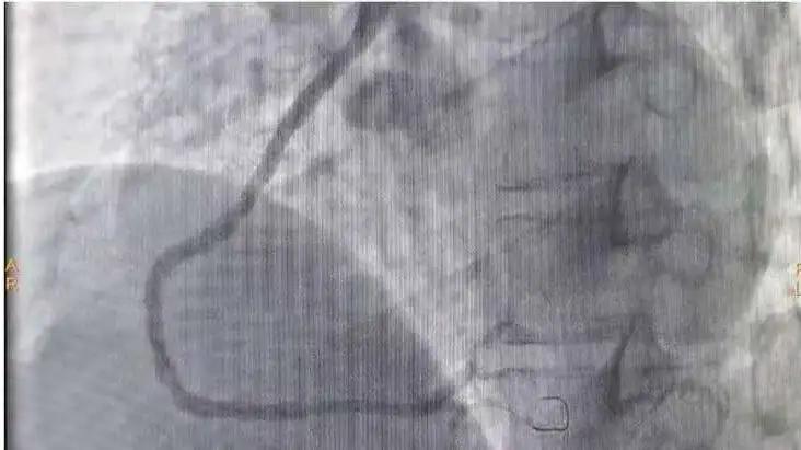 心血管疾病公益活动方案,榆林市星元医院支援政策