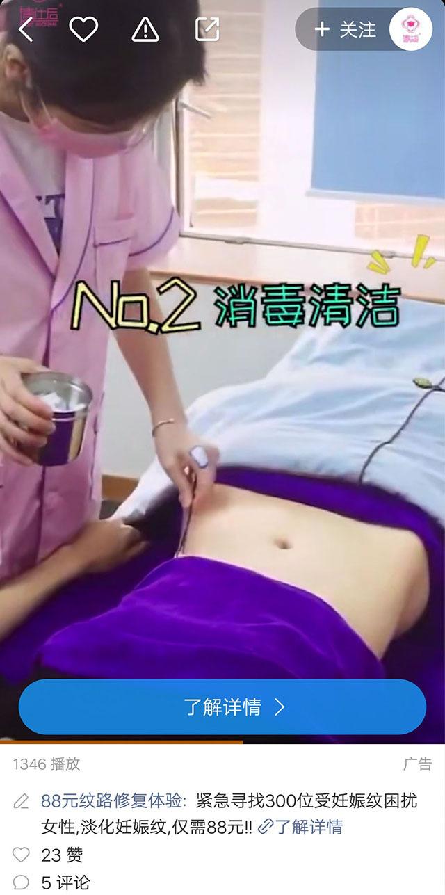 妊娠纹修复中心全国连锁,妊娠纹修复广告佛山