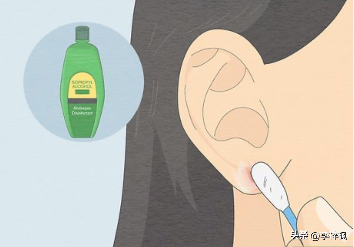 耳洞臭臭的怎么整啊,耳洞臭臭的是什么原因