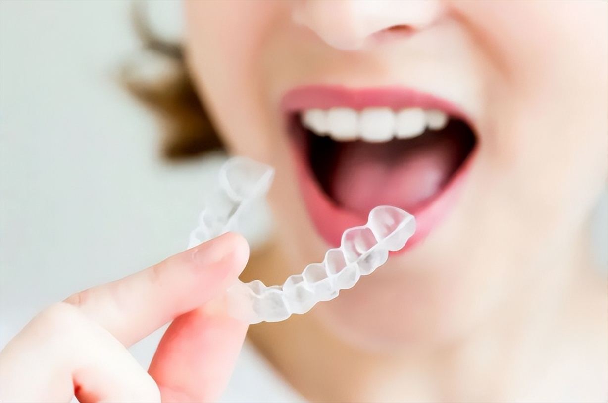 矫正牙齿想戴透明牙套,成人隐形牙套矫正牙齿大概多少钱