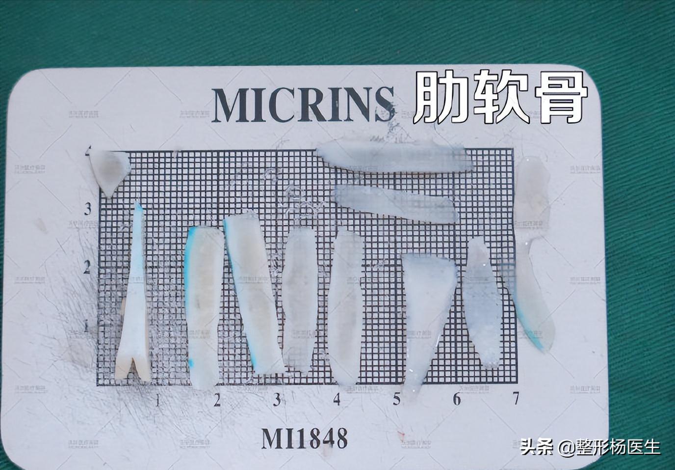 注射隆鼻和假体隆鼻哪个好,隆鼻和综合隆鼻整形有什么区别