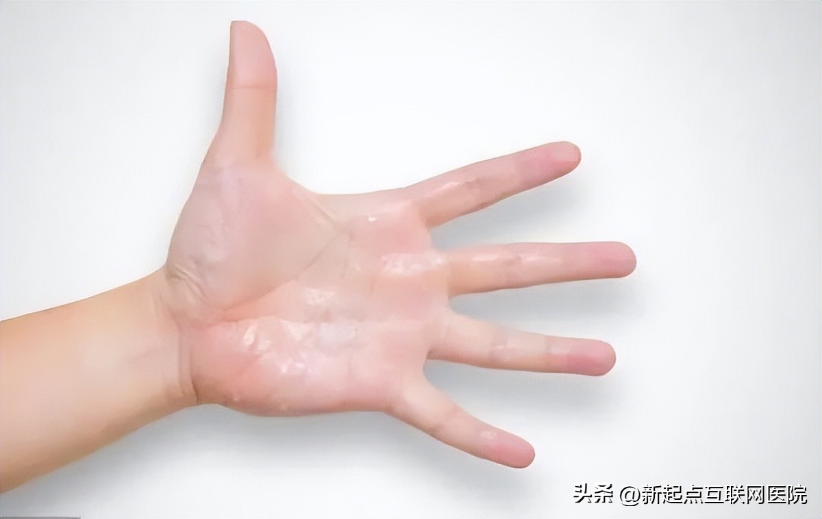 爱出汗和不爱出汗的人谁更健康呢,一动出汗和半天不出汗哪个更健康