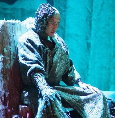 男子手长满树疙瘩是什么病,男子手长满树疙瘩手术了吗