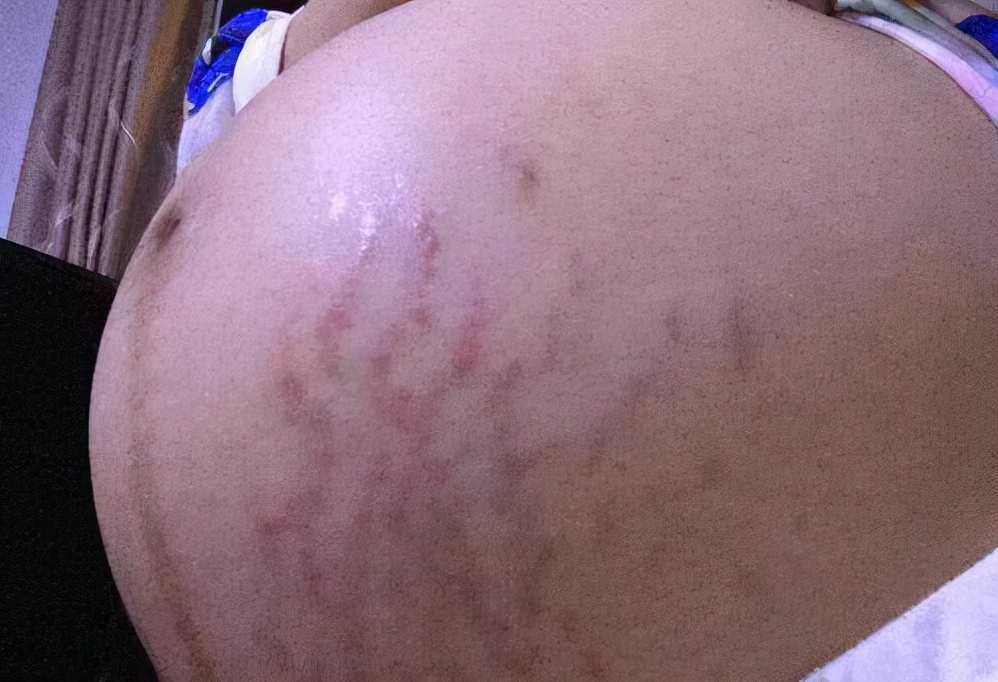 孕25周的胎儿是什么样的,怀孕25周胎宝宝是头位还是臀位