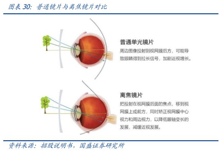 明月镜片防蓝光非球面镜片价格,明月近视防控镜片