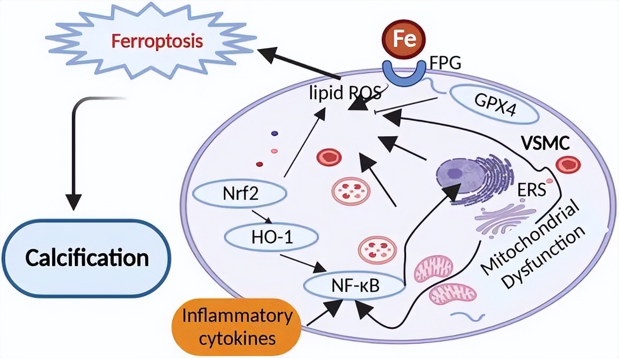 血管钙化的治疗方案,血管钙化的近年研究现状