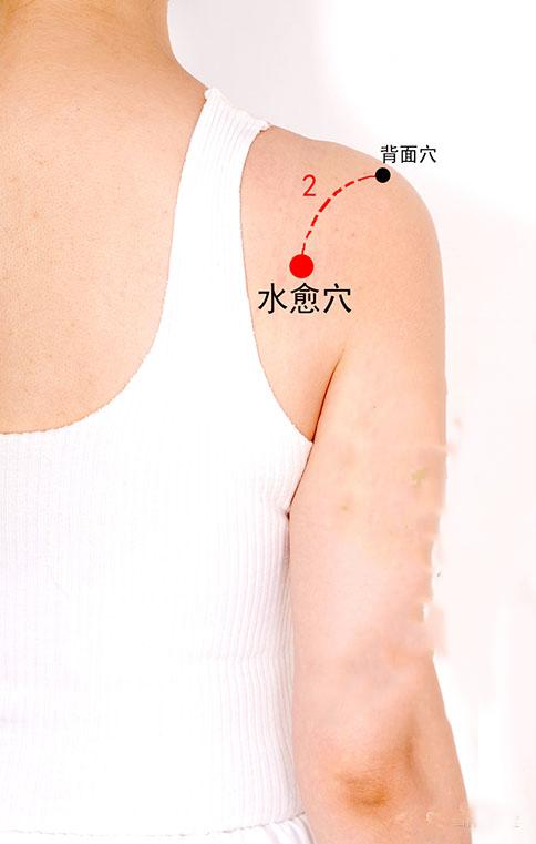 泌尿系疾病针灸,泌尿系统感染针灸哪里最有效