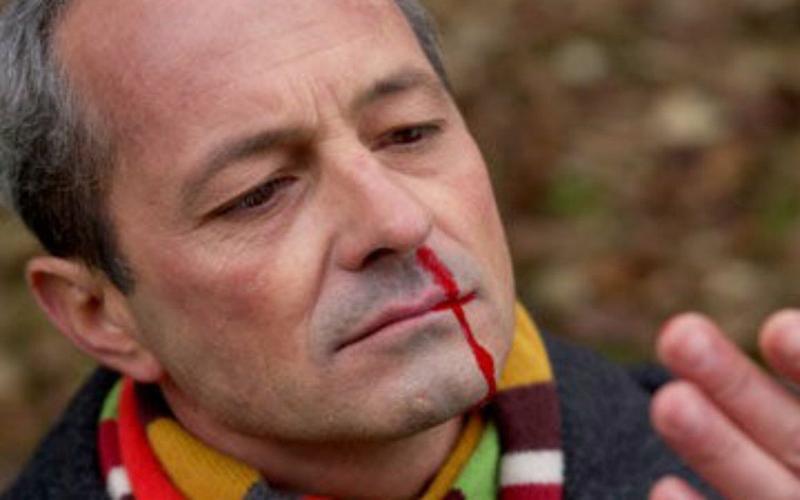 冰箱里一物或是白血病真凶,冰箱里这些食品可能得白血病