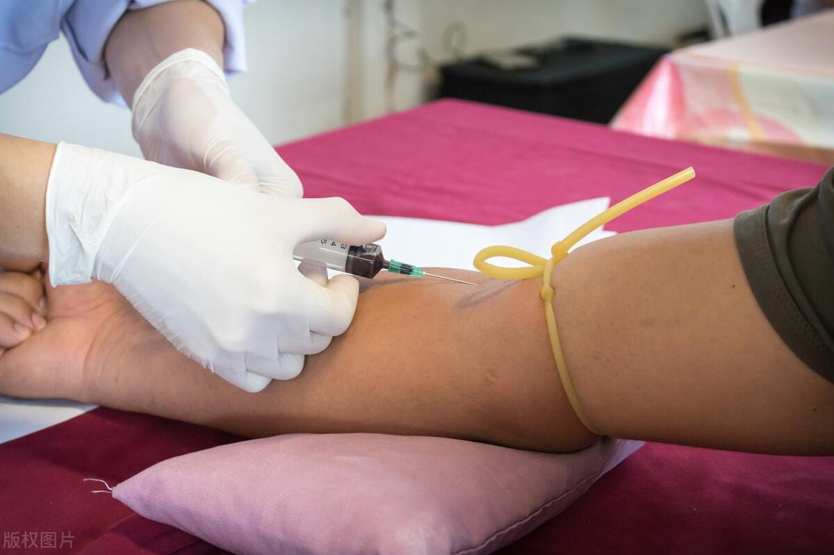 梅毒治疗如果没有随访会怎样,梅毒未经治疗可以自愈吗