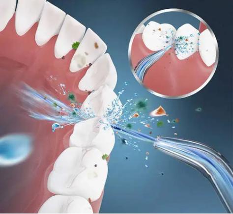 推荐好用性价比高的冲牙器,最护牙的冲牙器