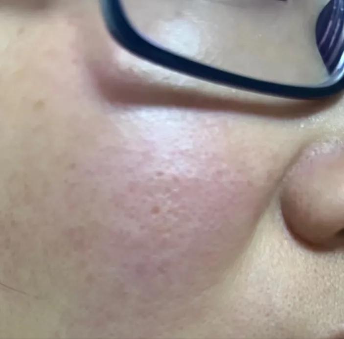 脸泛红是洗面奶的原因吗,为什么用完洗面奶脸会变白