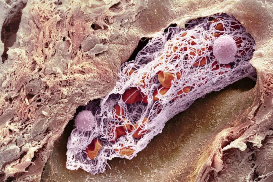 结痂的伤口，痒到怀疑人生，到底该怎么对待？看看医生怎么说