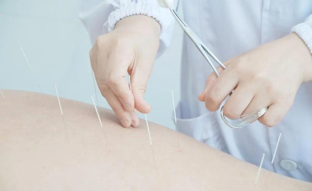 头部脑供血不足穴位,头部穴位针灸的作用