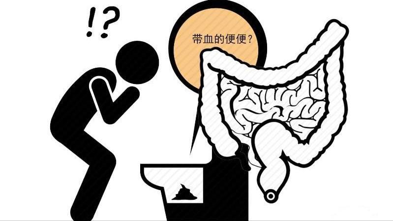 肛门出现潮湿瘙痒的症状,肛门潮湿瘙痒有臭味应怎么治疗