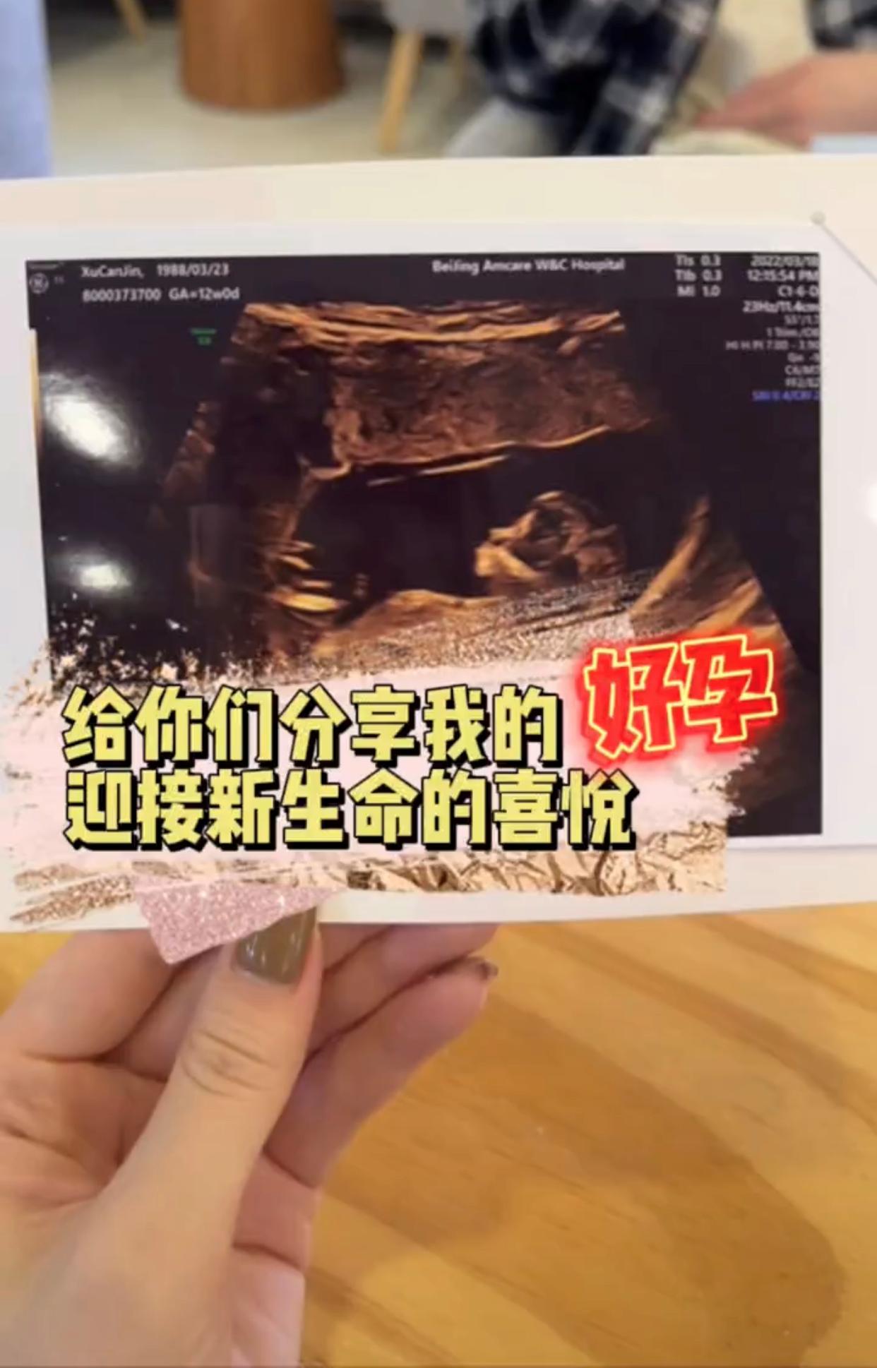 高晓松前妻曝多次危险经历,高晓松前妻近况