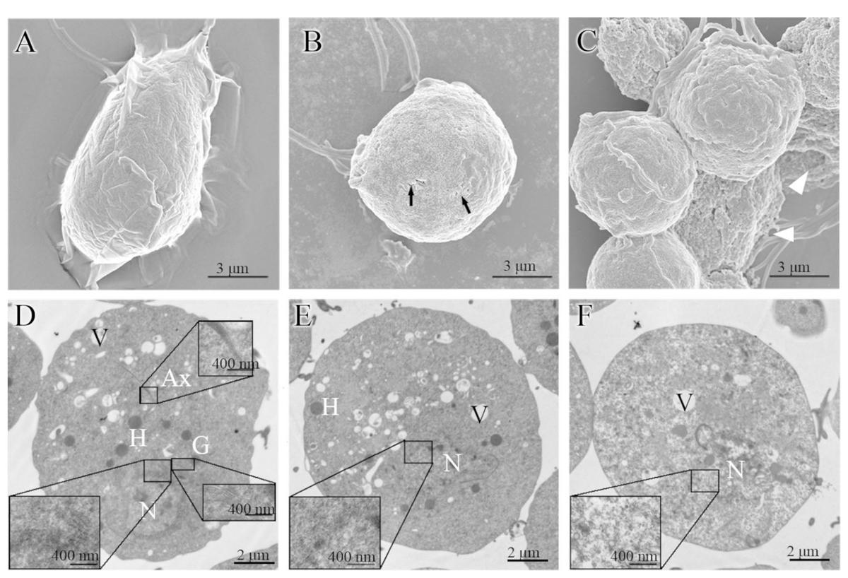 毛滴虫性妇科炎症甲硝唑,治毛滴虫用甲硝唑好还是替硝唑好