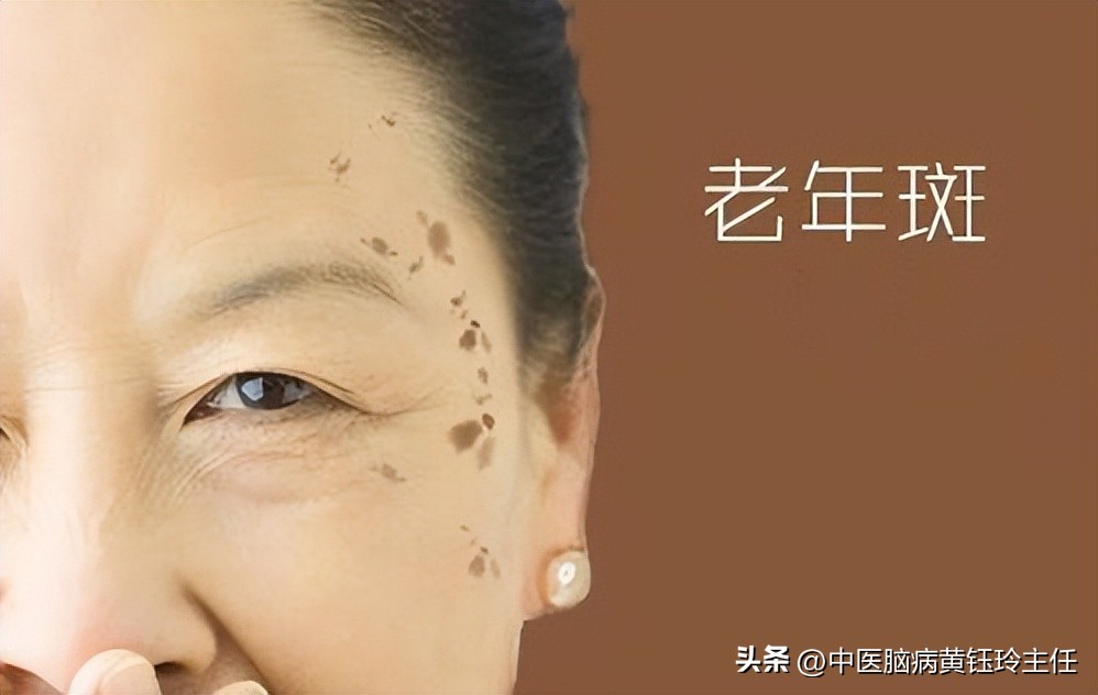 更年期不分男女，请正确认识它