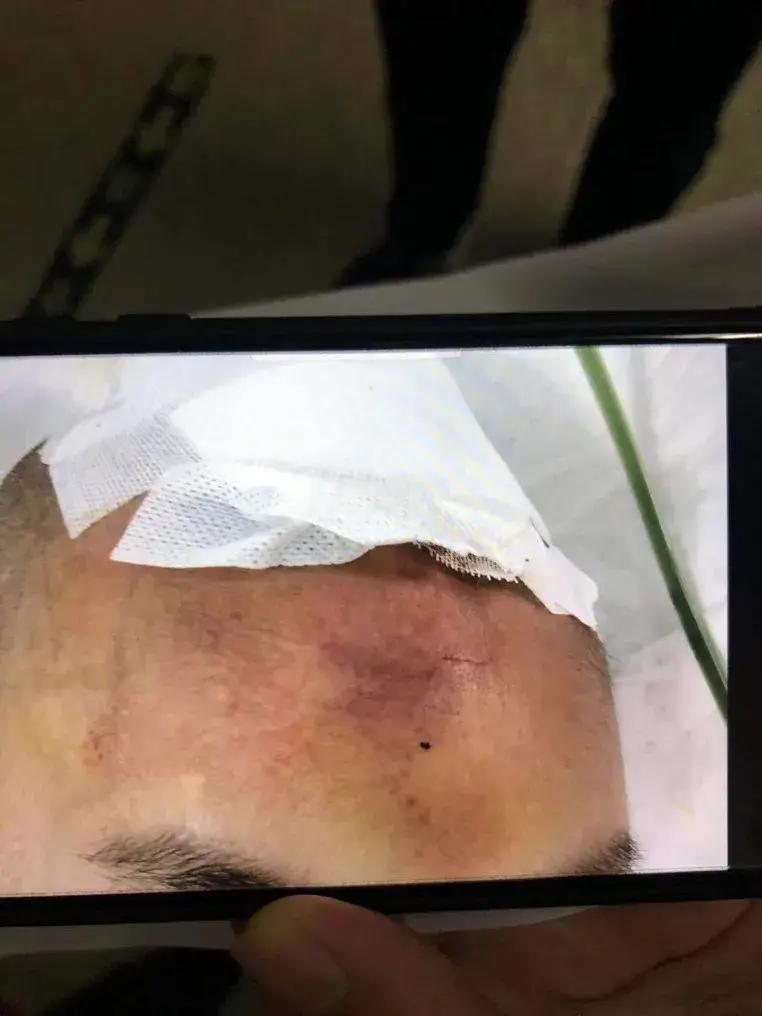 7岁孩子被少林寺和尚打死，只拘留14天罚500元，父亲维权至今无果