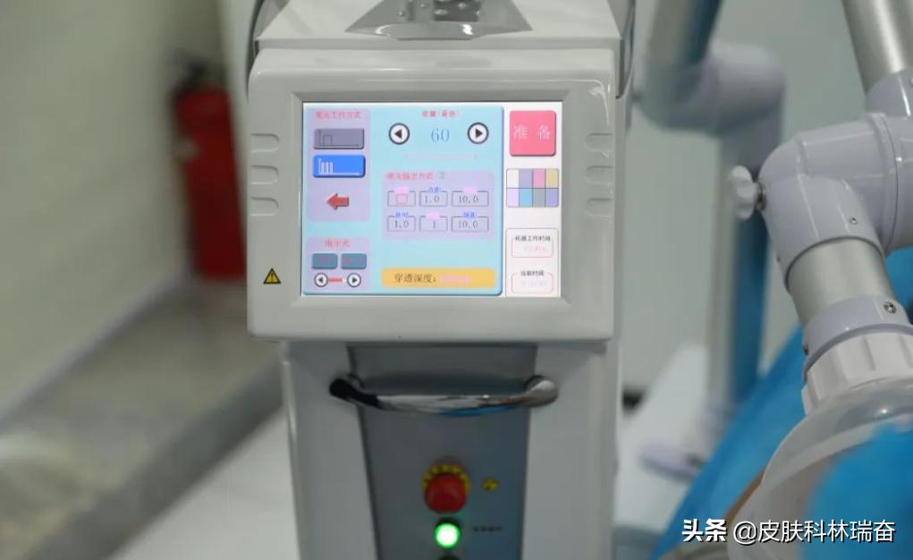 痘坑剥离激光点阵后长痘痘,脸上痘坑点阵激光治疗后效果图片