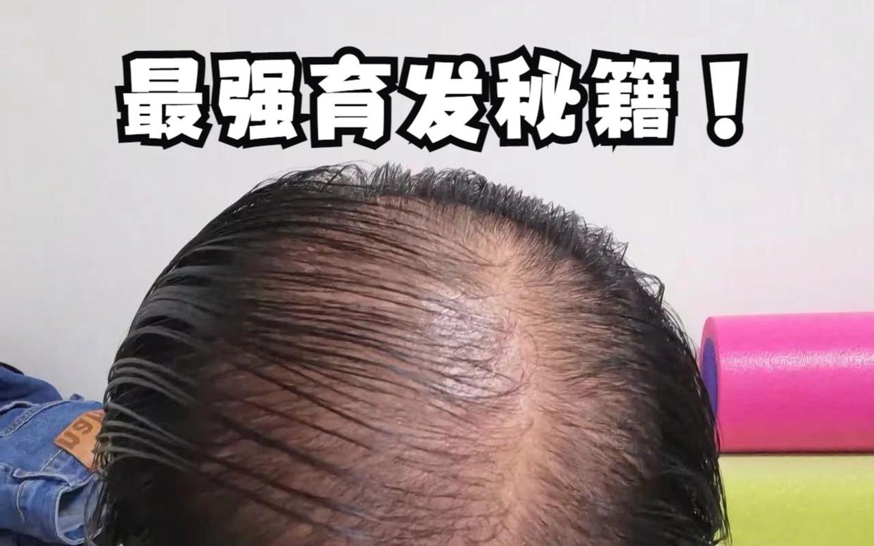 头顶一片光秃秃？过来人教你3招让发量翻倍！抓紧时间做起来！