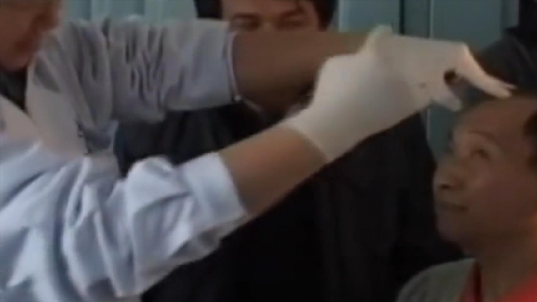 云南男子口臭手术后现在怎么样了,云南男子口臭查出了大毛病