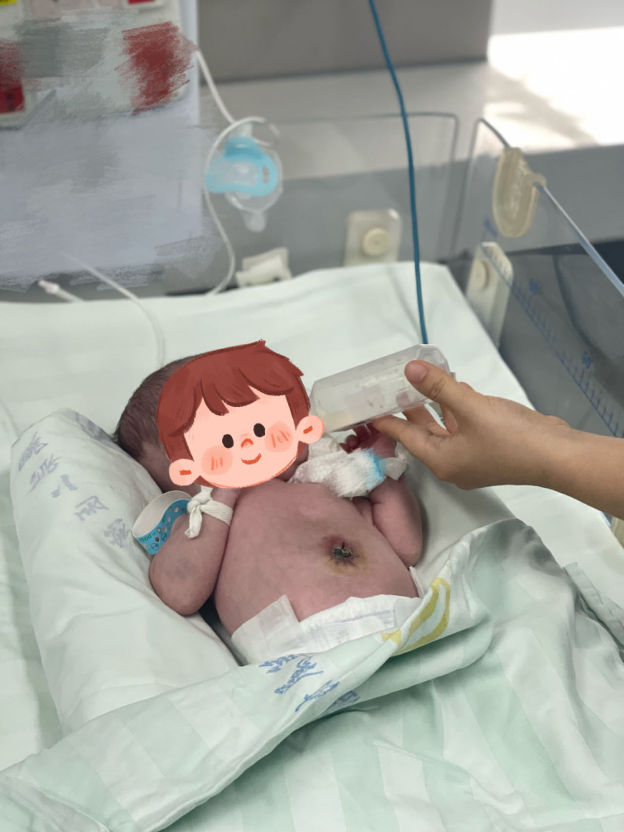 婴儿肚脐鼓出来上面有个肉球,50天的婴儿肚脐鼓出的是什么