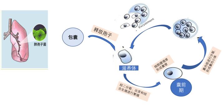 hiv感染肺孢子菌肺炎,hiv患者检查出耶氏肺孢子菌