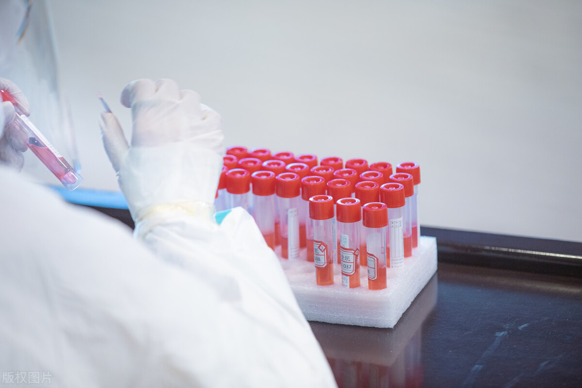 去日本旅游的条件和要求,去日本旅游有什么要求和条件