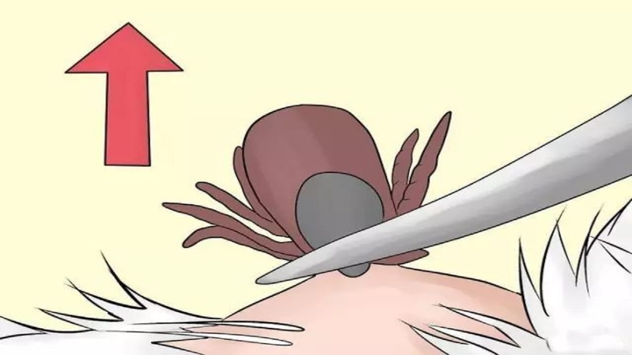 男性大量阴虱和虫卵,阴虱会寄生到身体哪些部位