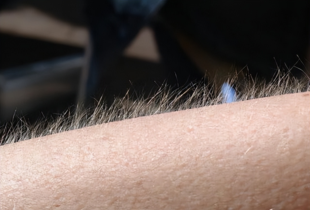 女性身上毛发旺盛什么原因呢,女性身上毛发旺盛什么原因