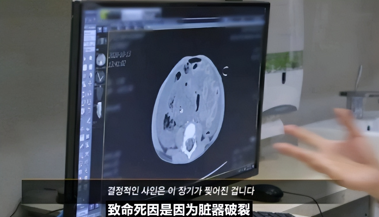 女孩被虐待致死案撤销原判,韩国虐待女童最新案件判死刑