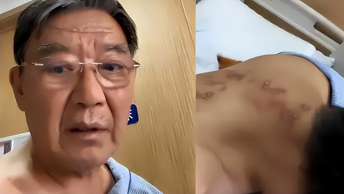 官方辟谣李立群杭州看病花20万,李立群带状疱疹原视频