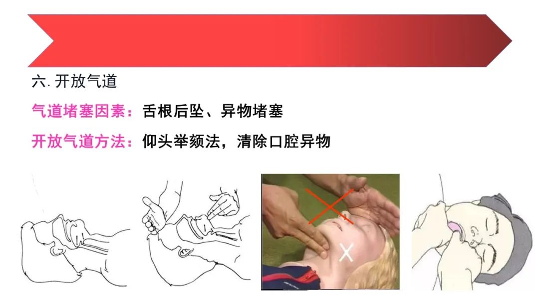 人工呼吸与心肺复苏操作方法ppt,心肺复苏技术ppt2021