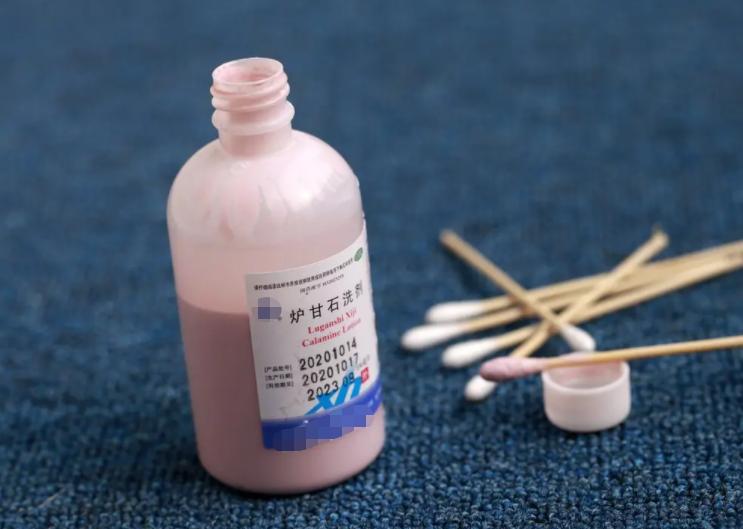 3块钱一瓶的炉甘石洗剂，连世卫组织都推荐，能用它来治哪些病？