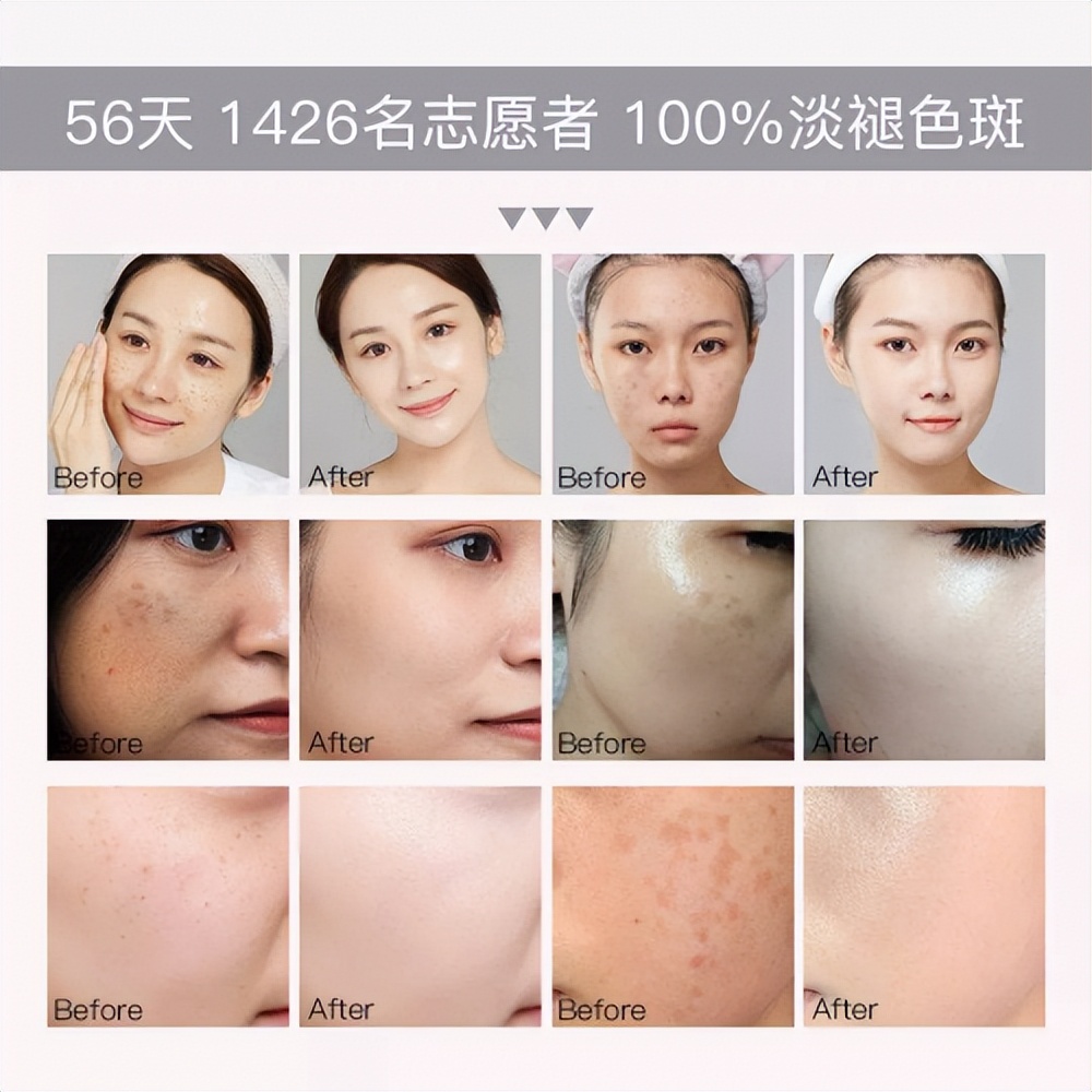 美白淡斑效果好又实惠的护肤品,淡斑美白效果好的护肤品