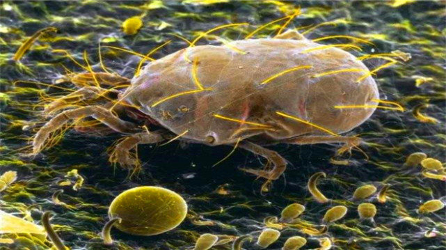 黑头在显微镜上是什么东西,脸上的黑头