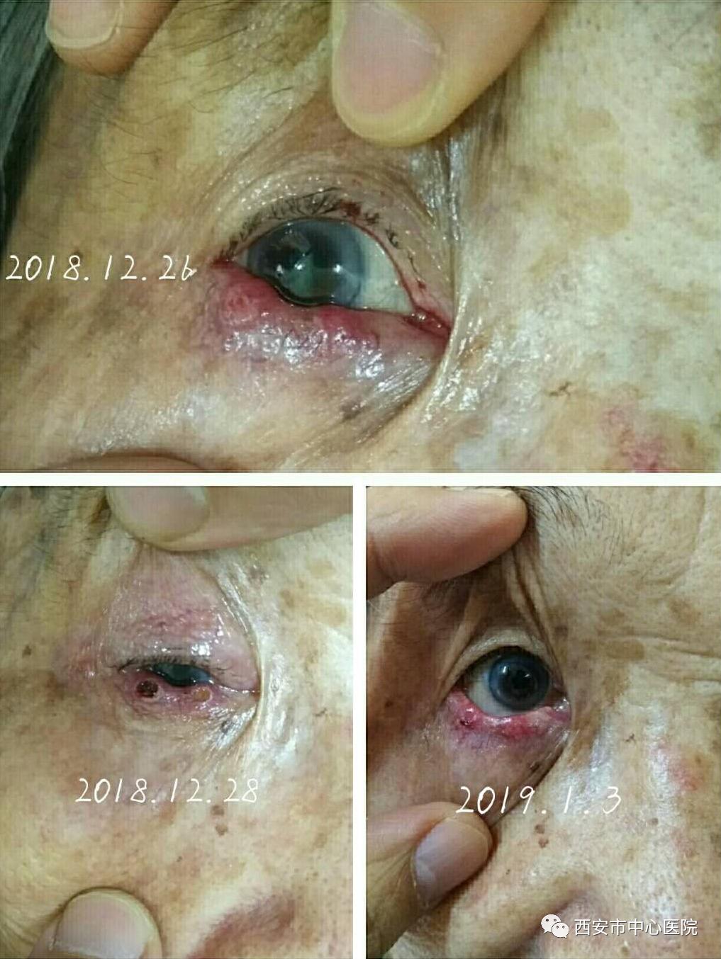 想美吗！找针灸！