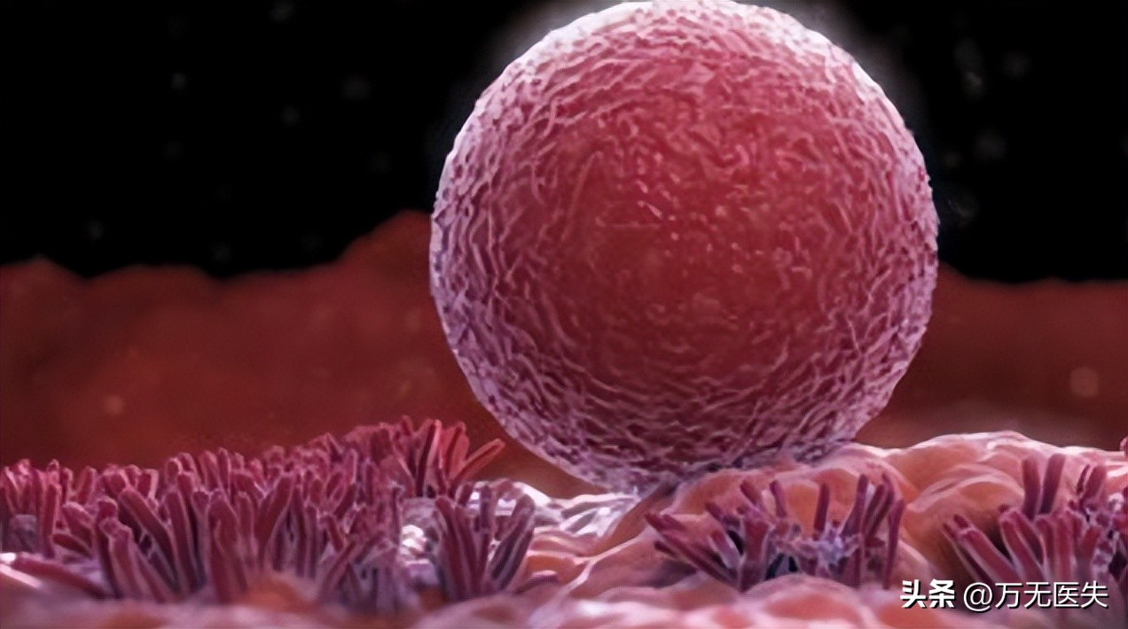 那些进入女性体内,没有成功“受精”的精子,最后都怎样了?